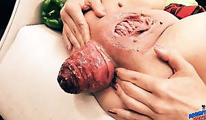 Insanely Huge Prolapse! Cervix Exposure. Eggplant Penetratio