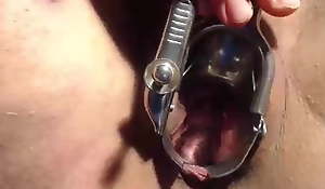 Speculum,show and touch my cervix exclude